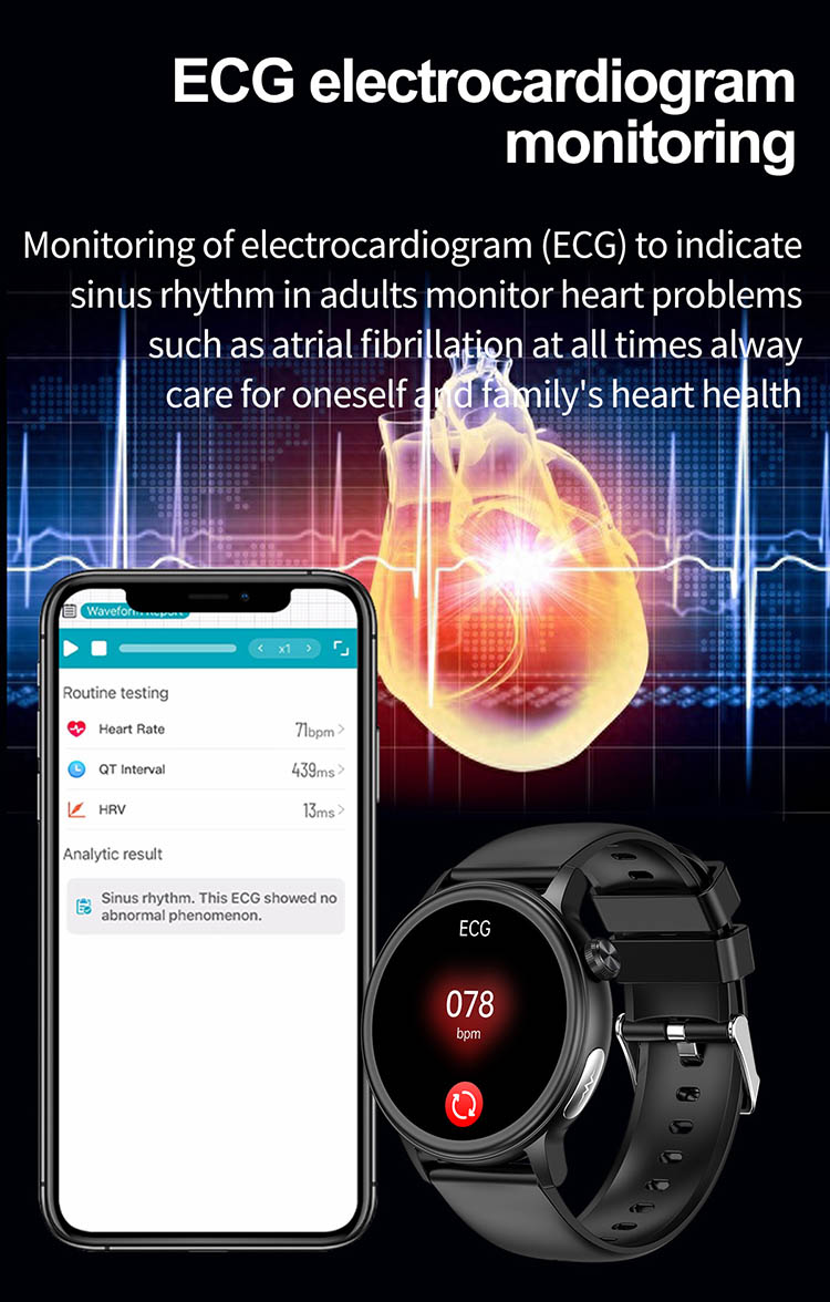 ET470 ECG Smartwatch